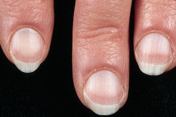 Как распознать болезни по состоянию кожи, языка и ногтей