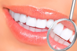 Один из самых простых и эффективных методов отбеливания зубов
