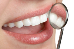 Как укрепить зубную эмаль в домашних условиях