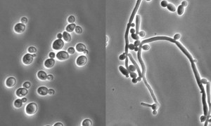 Грибок Candida albicans