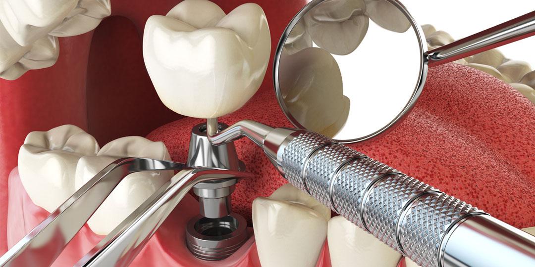 От чего зависит стоимость стоматологических услуг?