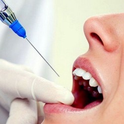 Борьба с болью на стоматологическом приёме