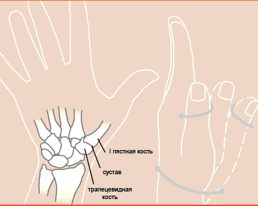 Артроз большого пальца руки фото