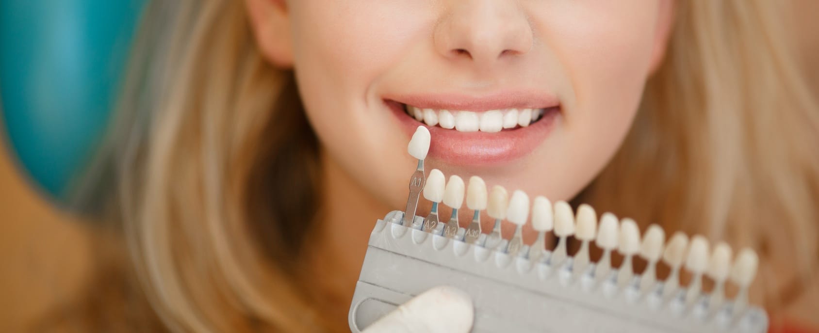 Что такое "эстетическая" стоматология?