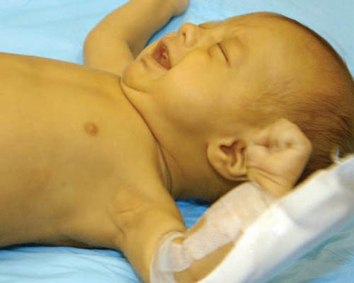 Ребенок рожденный с гепатитом С